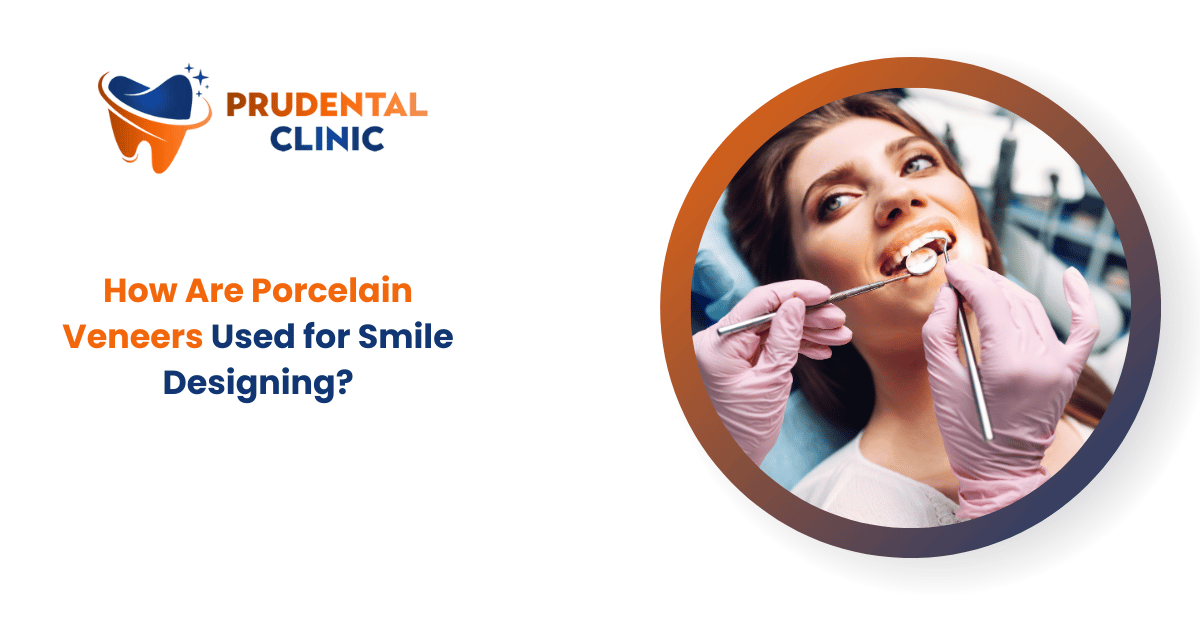 How Are Porcelain Veneers Used for Smile Designing?