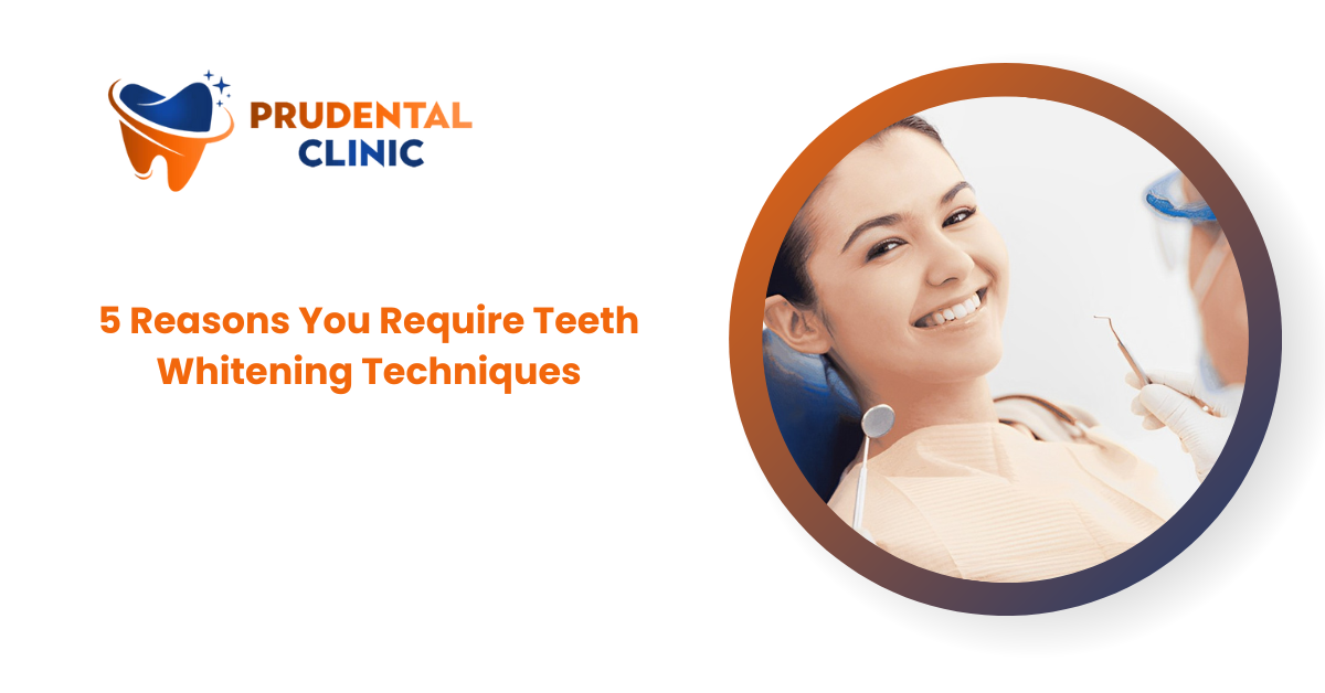 5 Reasons You Require Teeth Whitening Techniques
