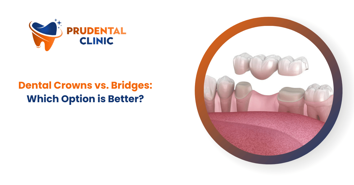 Dental Crowns vs. Bridges: Which Option is Better?